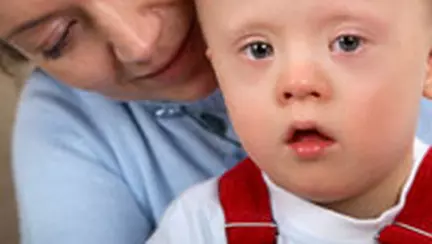 Despre sindromul Down