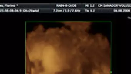 Un ingeras mi-a schimbat viata