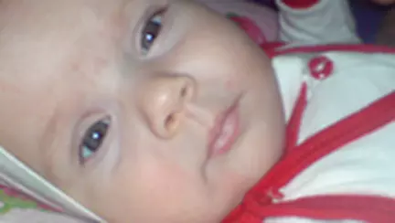 Eruptia dintisorilor