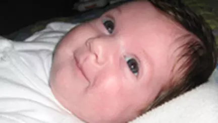 Dermatita tratata cu apa