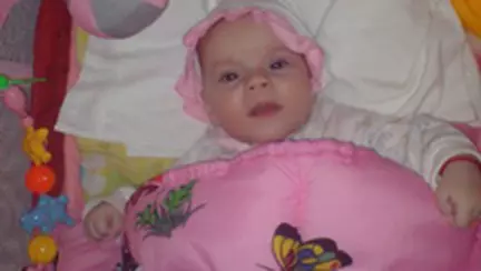 Iritatia la bebelusi