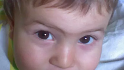 Cum ne calmam nervii