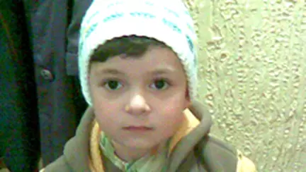 Ti-au cazut cativa dinti tanti