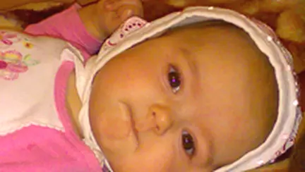 Probleme cu ochisorii