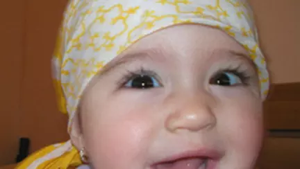 Iritatie in zona scutecului