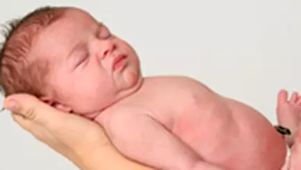 Cum am vindecat icterul