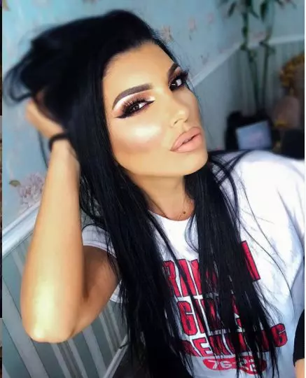 Andreea-Tonciu-operaíi-estetice5