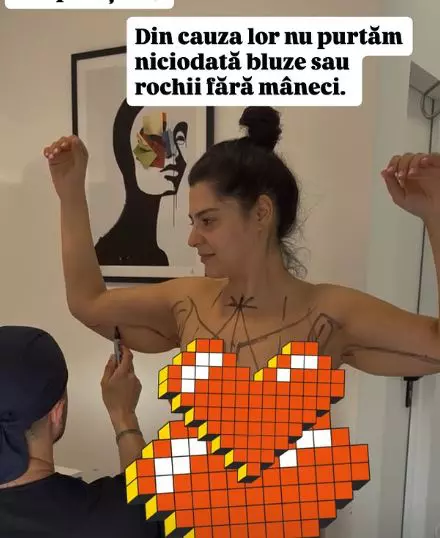 ioana state operatii estetice