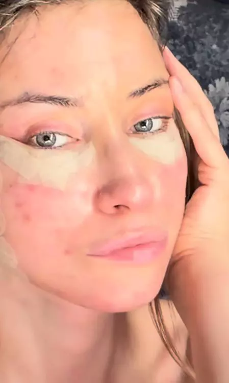 iulia albu inteerventie faciala