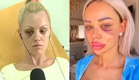 Vedetele din România, victime ale violenței domestice. Au povestit public prin ce au trecut