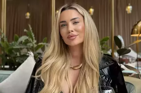 Oana Monea, de nerecunoscut după ce și-a făcut două operații estetice la nivelul feței. Cum arată acum fosta ispită de la Insula iubirii: „Cu siguranță a dat greș”/ „Arăta mai bine înainte”