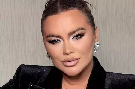 Carmen de la Sălciua, de nerecunoscut după ce și-a schimbat look-ul. Fanii cred că a exagerat puțin: „De ce faci asta?”