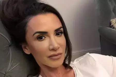 Ce operații estetice are Mara Bănică? Cum arăta înainte de îmbunătățirile fizice. Nimeni nu a recunoscut-o