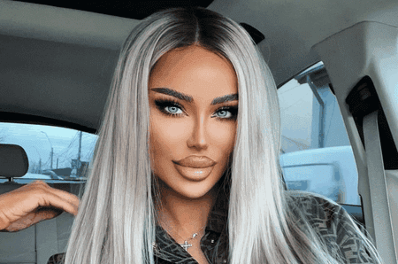 Bianca Drăgușanu s-a operat din nou. Vedeta a apărut cu capul bandajat: „Am făcut-o și pe asta!”