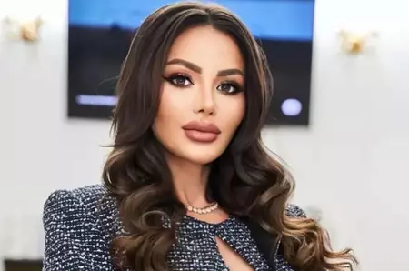 Senatoarea POT Valentina Aldea, atacată cu ranga de soția iubitului ei, într-un complex de locuințe din București: "Am fost lovită fără motiv. Violența nu e un subiect de bășcălie!"