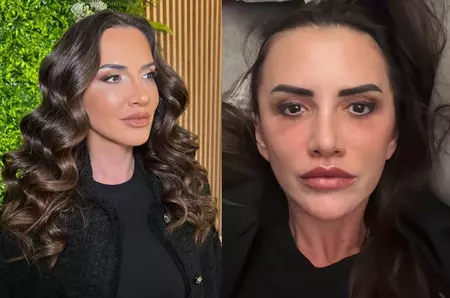 Mara Banică a răbufnit după ce a fost aspru criticată în urma liftingului facial: "Mi-am recăpătat strălucirea după cea mai grea perioadă din viața mea"