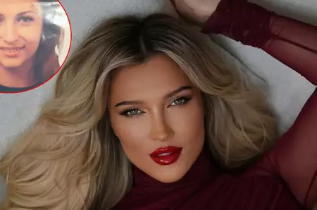 Cum arăta Lora înainte de intervențiile estetice. Artista a spus ce modificări și-a făcut la nivelul feței: „Nu am liftinguri făcute sau fire”