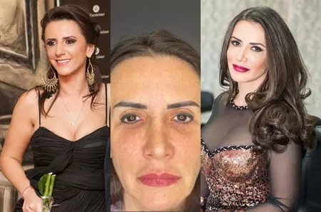 Mara Bănică, răspuns tranșant după operația la față. Imagini incredibile înainte și după: „Cred că sunt un exemplu de lifting facial reușit”