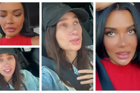 Olga Barcari face declarații șocante despre Alina Pușcău. Cât o costă pe vedetă să scape de tumorile abia descoperite de medici: “Încearcă să strângă și ea niște fonduri.”
