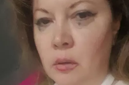 Oana Lis, în lacrimi după ce a ajuns pe patul de spital. Ce a pățit soția lui Viorel Lis