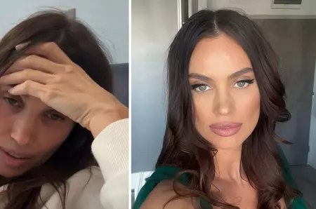 În ce stare se află Alina Pușcău după tratament: „Abia mă țin pe picioare, am slăbit 10 kilograme”. Vedeta trece prin clipe de coșmar