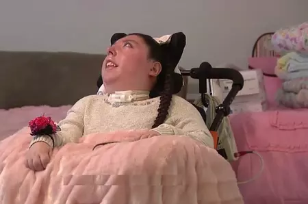 Trăiește de 20 de ani fără o mare parte din creier. Povestea incredibilă a lui Alex Simpson