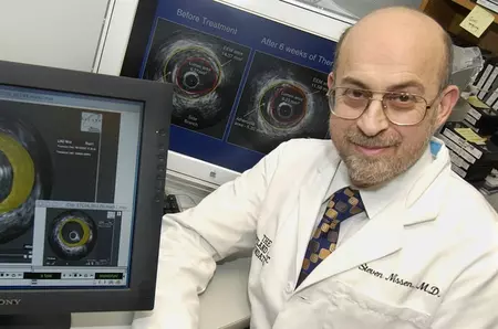 Un tratament unic ar putea reduce colesterolul cu 50%. „Acum 15 ani v-aș fi spus că e o nebunie”