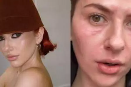 Lidia Buble i-a șocat pe fani! Fața artistei este de nerecunoscut: „Zici că mă transform într-o reptilă”