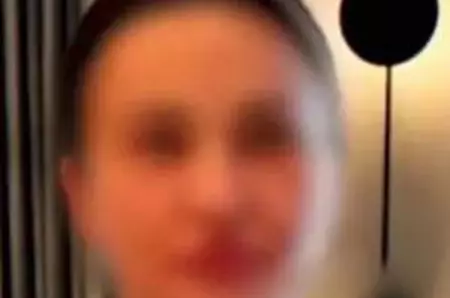 Femeie din Râmnicu Vâlcea, în moarte cerebrală din cauza unei intervenții estetice! Cum răspunde medicul