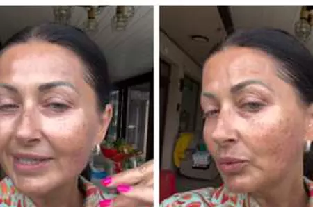 Gabriela Cristea a vorbit despre intervenția cu laser la față. Vedeta a explicat de ce are pete