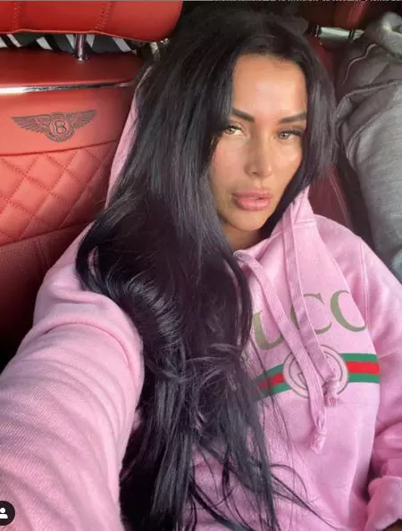 Daniela-Crudu-intervenție-estetică