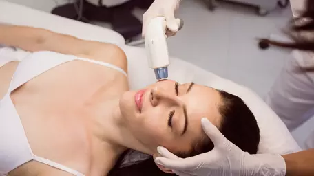 De ce sezonul rece este perioada potrivită pentru rejuvenare laser