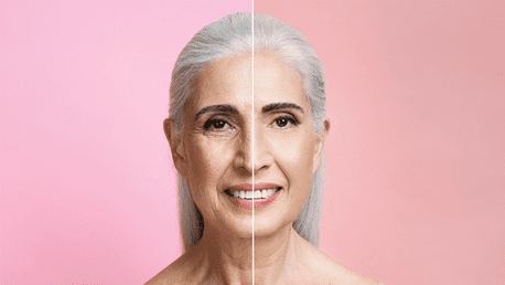 De la cicatrici la riduri fine: află cum laserul CO₂ reface textura perfectă a pielii