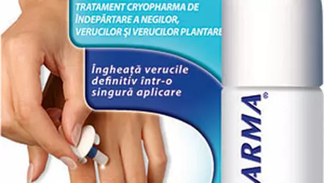 Tratament pentru veruci