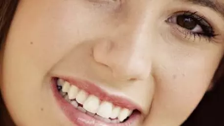 Fatete dentare – pentru un zambet perfect