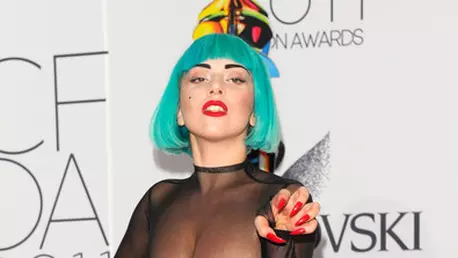 Lady Gaga, amendata in Franta