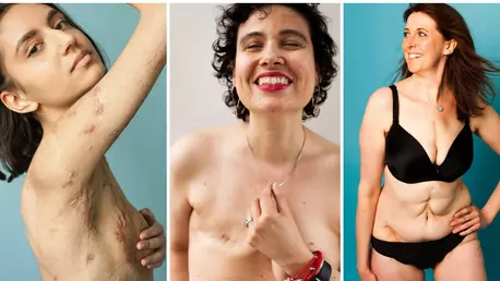 Puterea cicatricelor: Behind the Scars