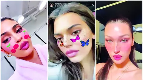 Operațiile estetice pentru generația Snapchat, un trend controversat care face valuri în acest moment