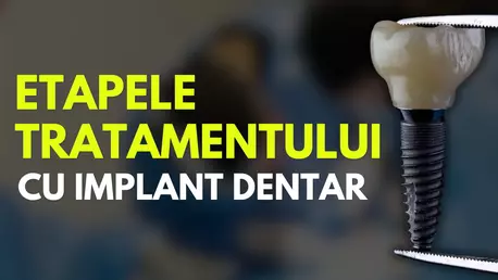 De la consultație la zâmbetul complet: Etapele tratamentului cu implant dentar