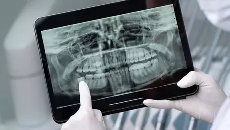 În ce cazuri este recomandată o radiografie dentară?