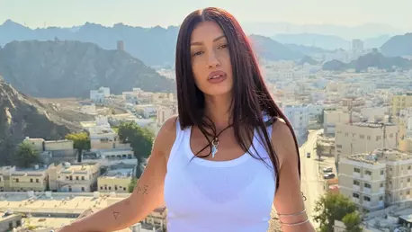 Imaginea cu care Alina Eremia și-a îngrijorat fanii. De ce artista a apărut cu fața umflată pe internet: "Din păcate..."