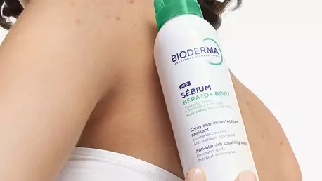 Acneea corporală și cicatricile post-acneice: de ce apar și cum le tratezi