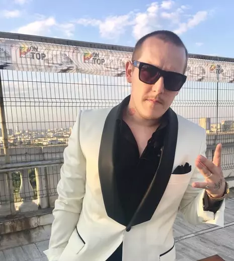 What’s Up s-a operat de urgență. Artistul risca să-și piardă vederea