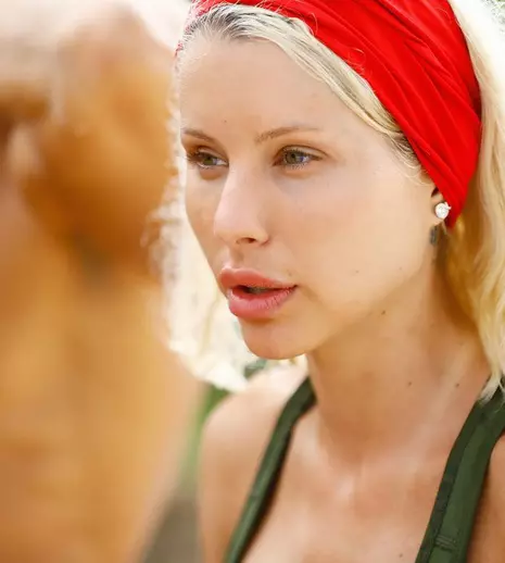 Carmen Grebenișan, probleme cu tenul la „Survivor România”. „Am făcut o acnee gravă care a persitat până la final”. EXCLUSIV