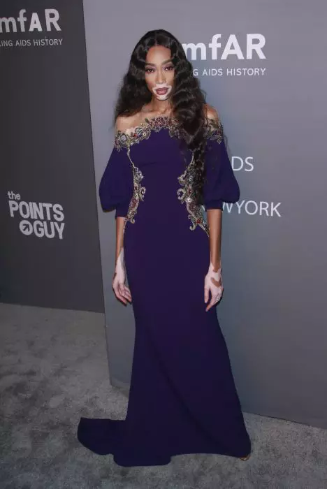 Winnie Harlow