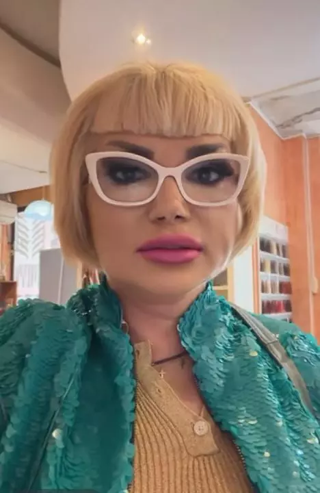 Cum arată Ozana Barabancea după liftingul facial. Vedeta a mărturisit că se vindecă greu: „Am rezultatul dorit”