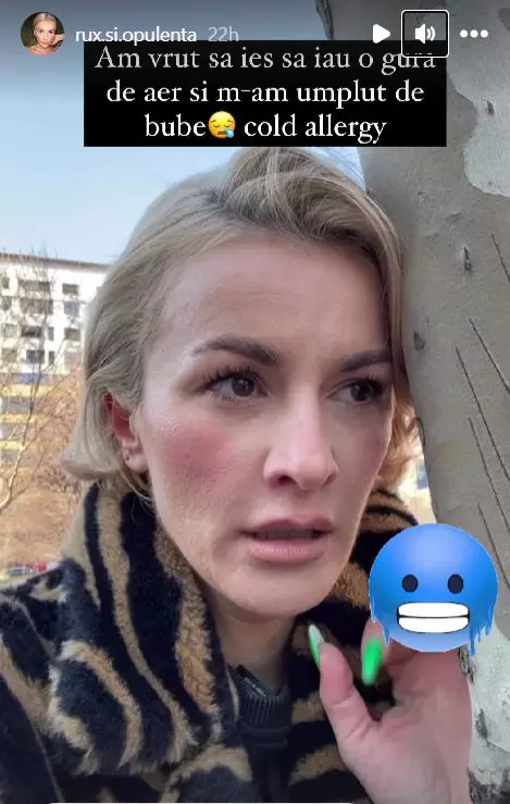 ruxi-se-confrunta-cu-o-problema-de-sanatate.-de-ce-nu-vrea-sa-apeleze-la-ajutorul-unui-medic-2