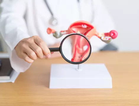 (P) Endometrioza poate fi vindecată? Ce opțiuni de tratament sunt?