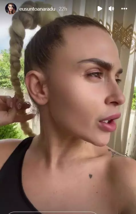 Cu-ce-problema-de-sanatate-se-confrunta-Oana-Radu-1-1