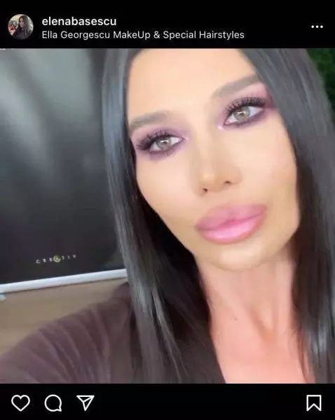 Elena-Basescu-operatii-esteticde-478x600